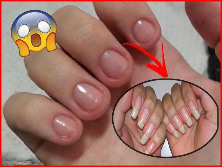 Receitas caseiras para crescer unhas em 2 semanas Receitas caseiras para crescer unhas em 2 semanas
