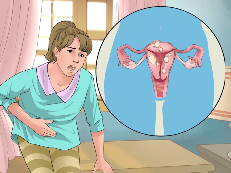 tratamento para menstruacao irregular tratamento para menstruacao irregular