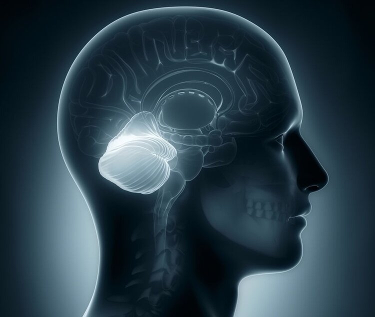 Ataxia Cerebelar Aguda Ataxia Cerebelar Aguda