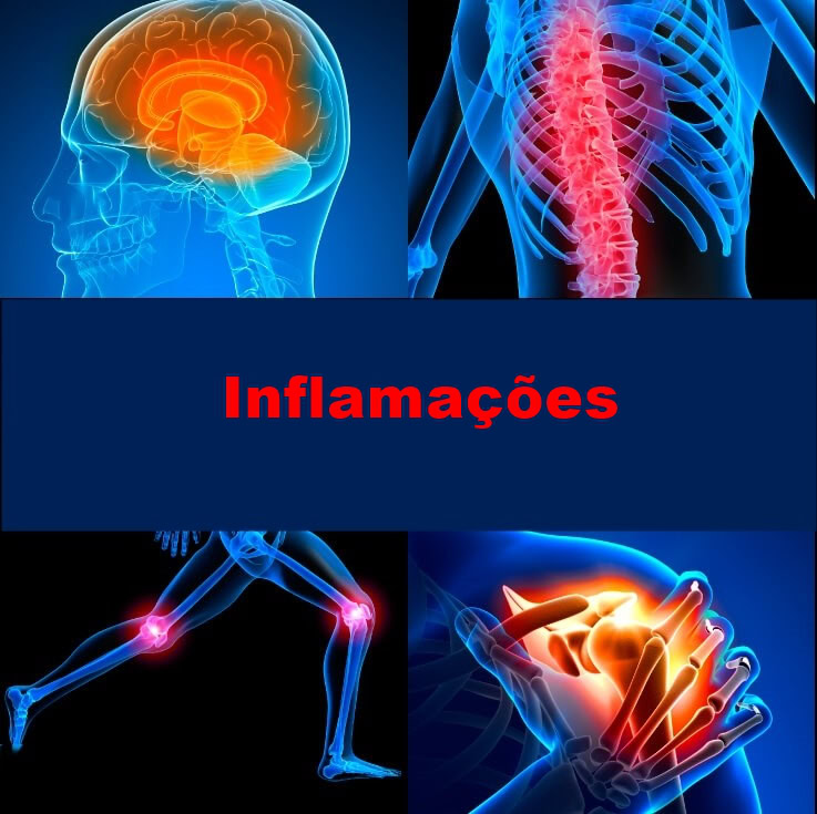 Chá Para Inflamações no Corpo Chá de noz-moscada para reduzir as inflamações no corpo (e como fazer)