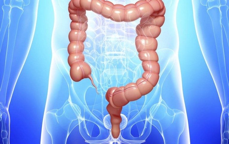 inflamaçao do colon