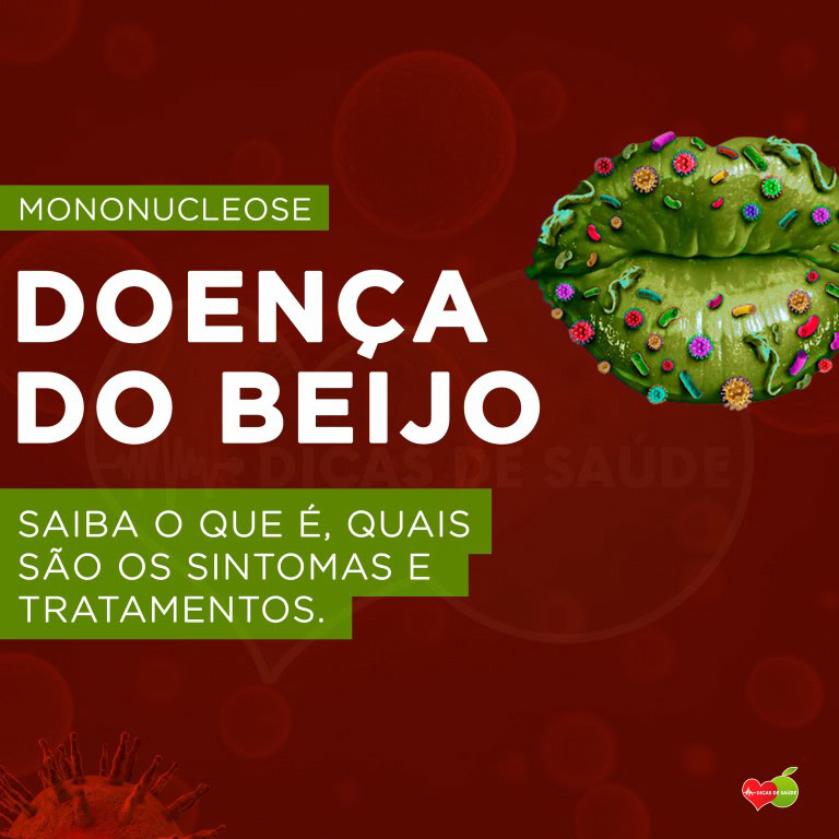 Doença do beijo: o que é, quais são os sintomas e tratamentos | Dicas ...