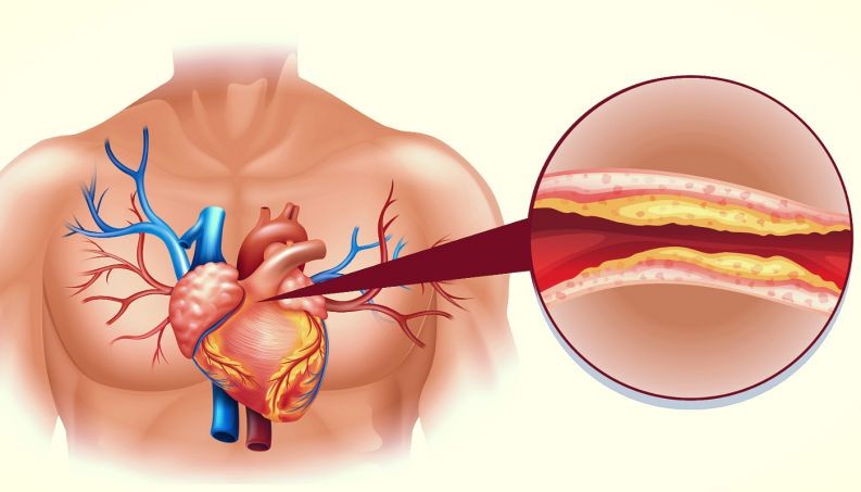 alimentos com alto teor de colesterol alimentos com alto teor de colesterol