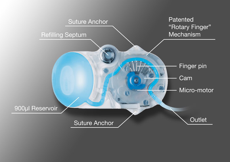 iPrecio Pump Front Caption