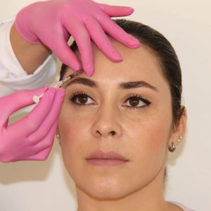 Botox® (Toxina Botulínica) e Preenchimento Facial