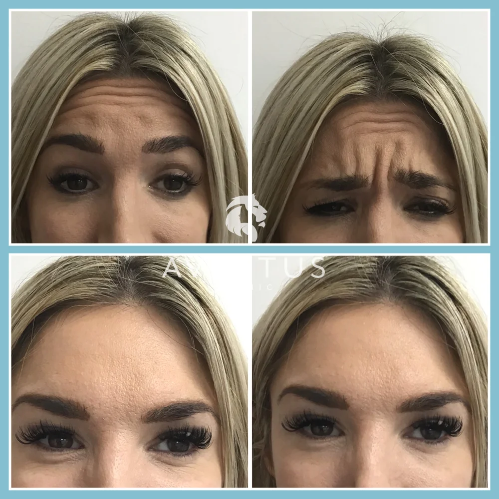 Skin Clinic Before And After 2