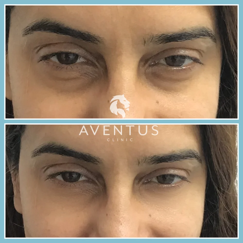 Skin Clinic Before And After 1