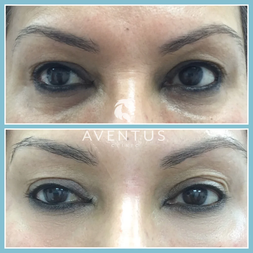 Skin Clinic Before And After 3
