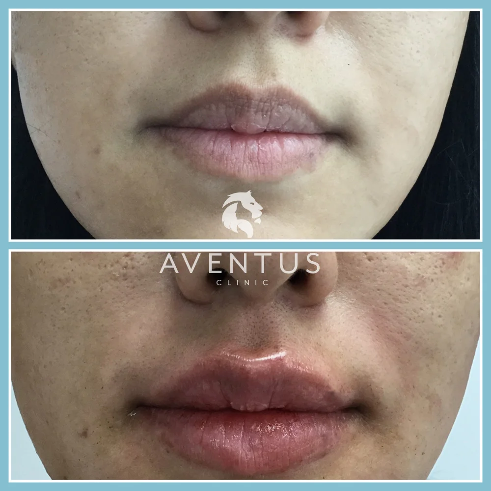 Skin Clinic Before And After 4