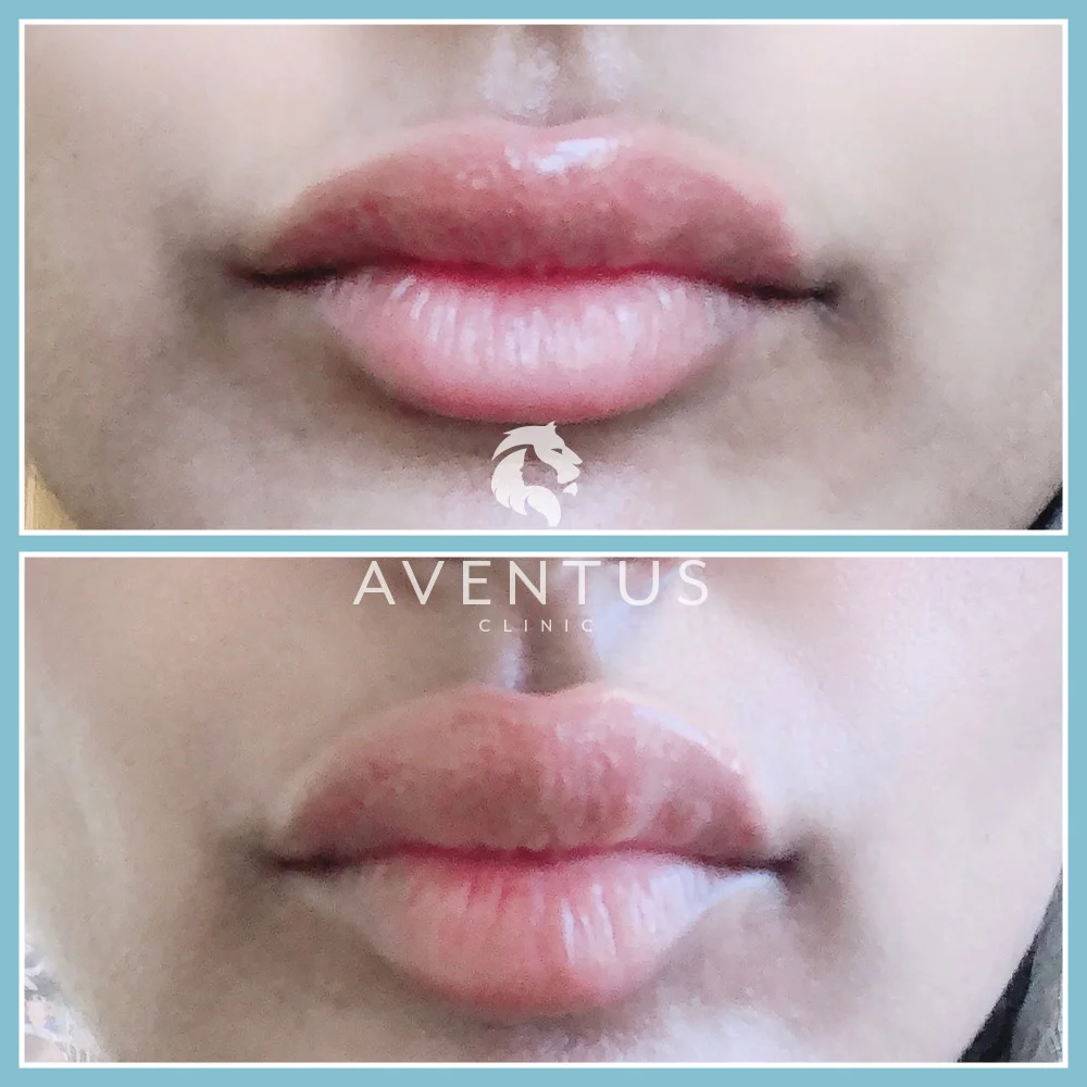 Skin Clinic Before And After 5