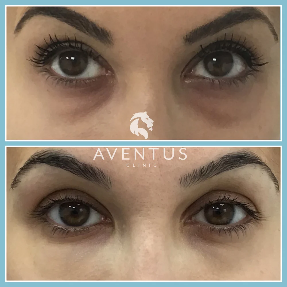 Skin Clinic Before And After 6