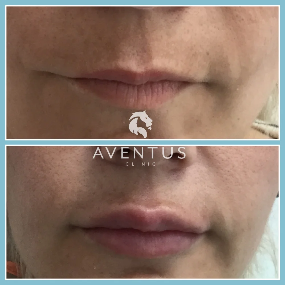 Skin Clinic Before And After 7
