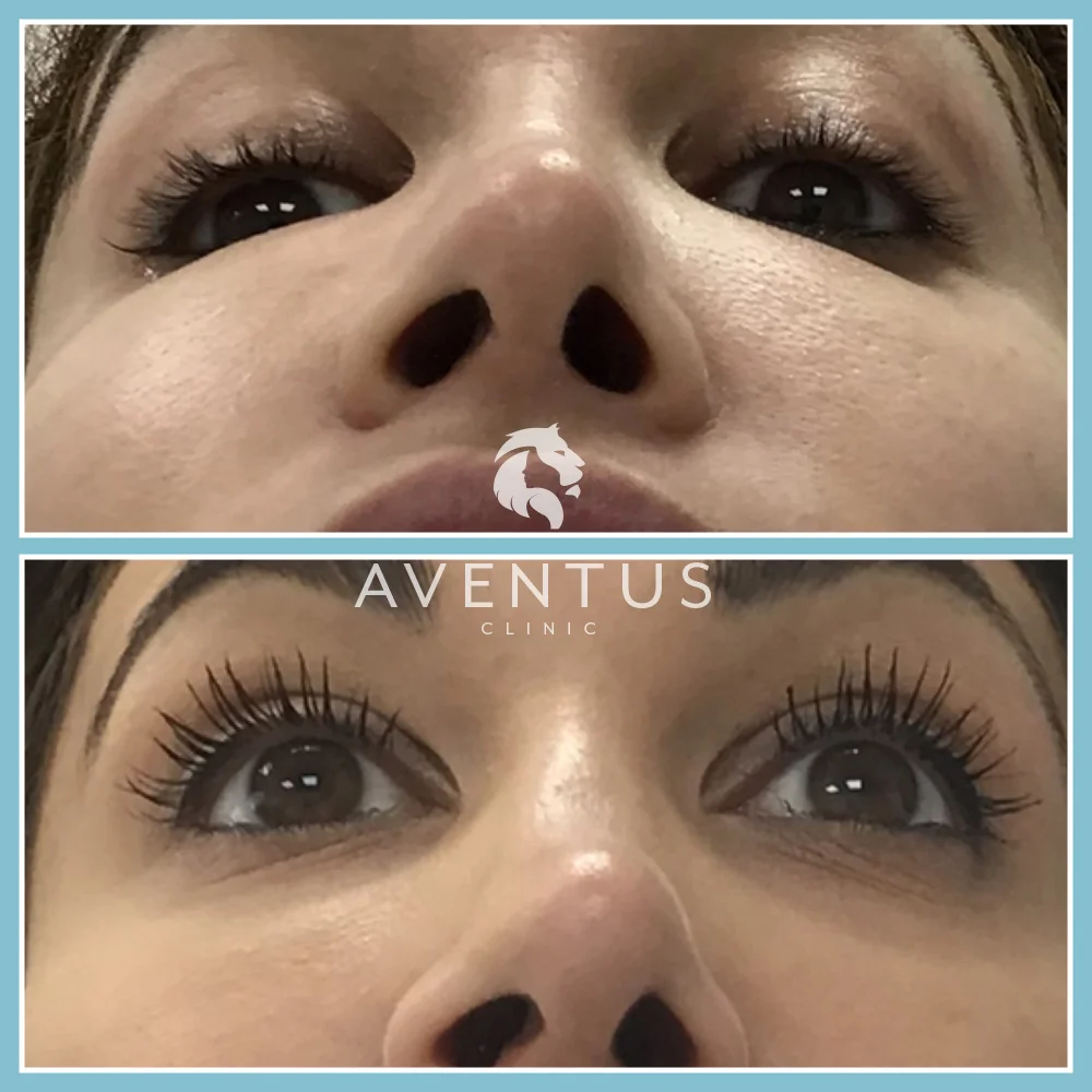 Skin Clinic Before And After 8