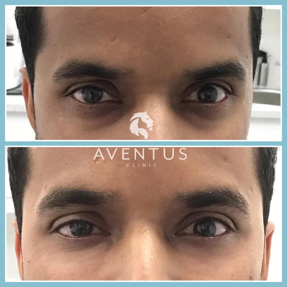 Skin Clinic Before And After 9