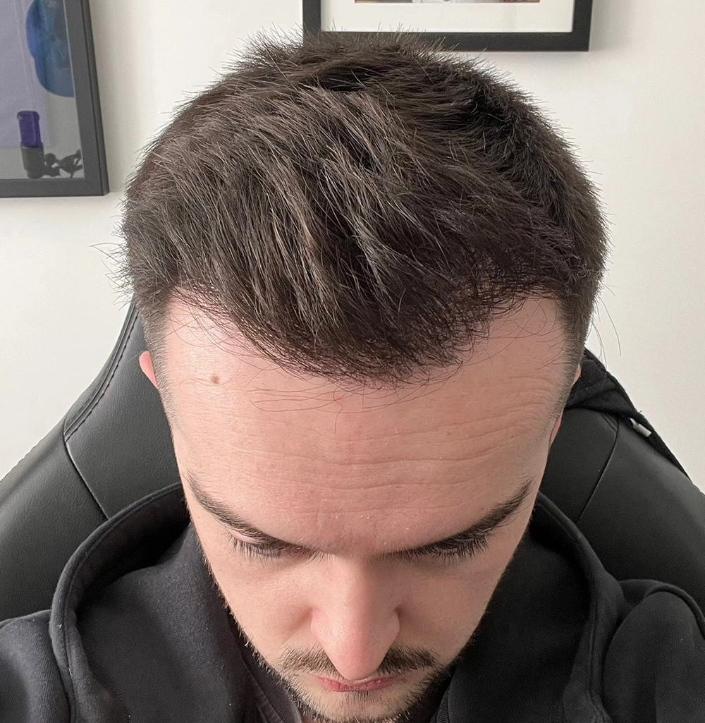 Danny After