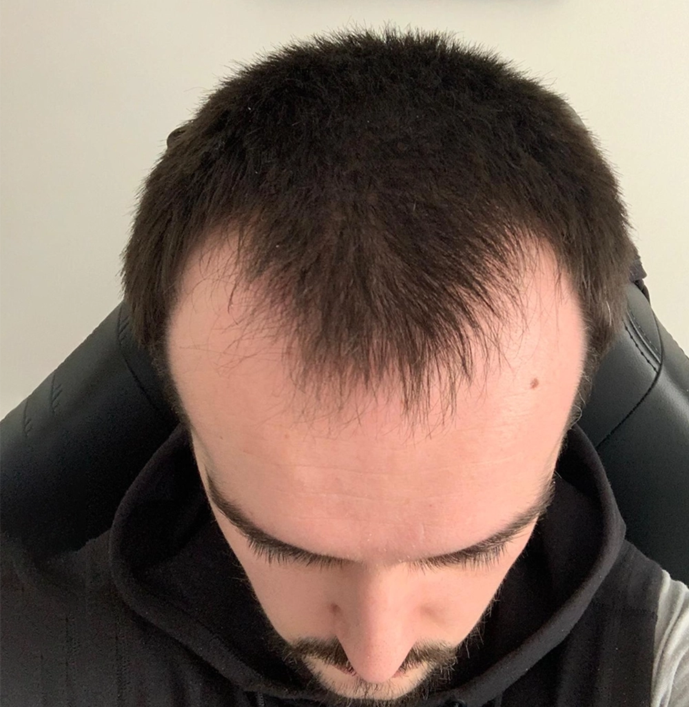 Danny Before