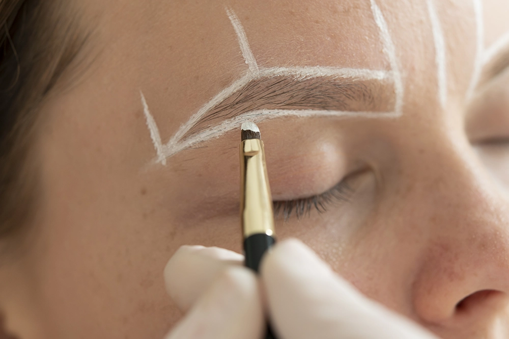 Eyebrow Transplant