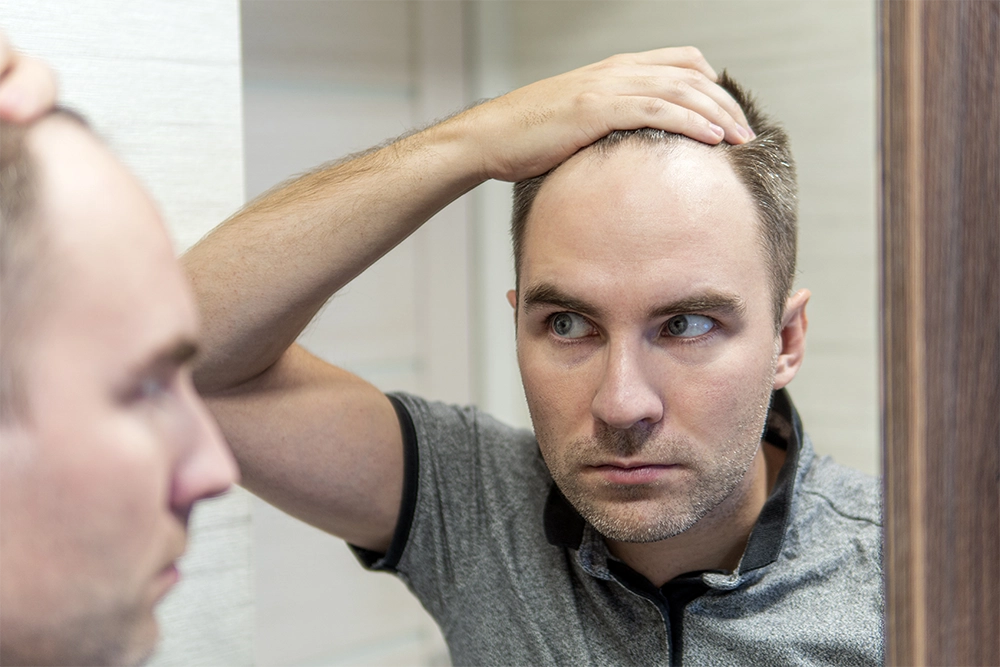 Photo of a man inspecting his receding hairline in the mirror