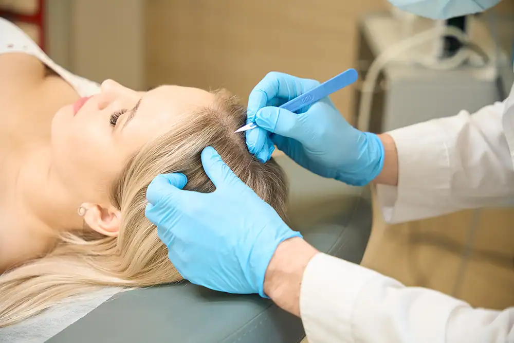 Cyst On Scalp