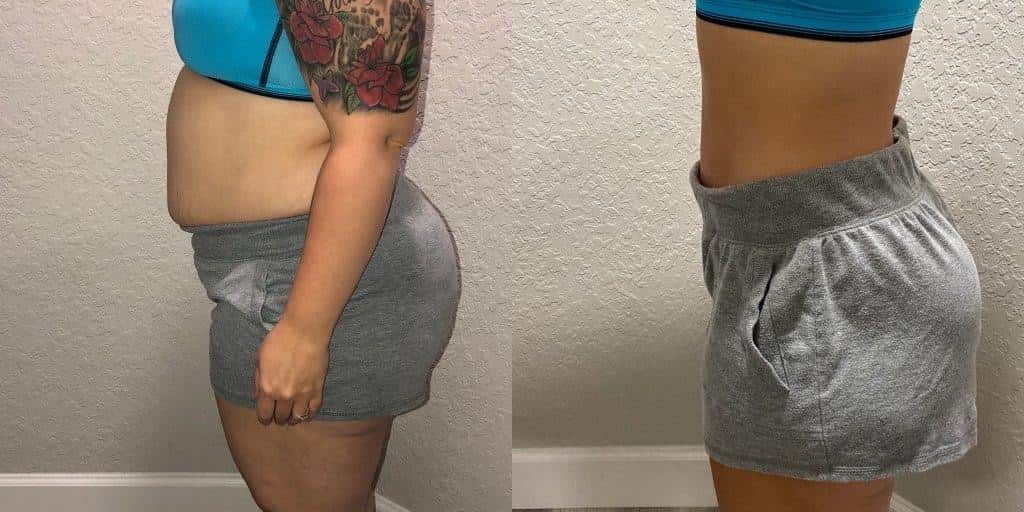 Is Phentermine For Weight Loss Safe? An Overview Brandon Medical Center