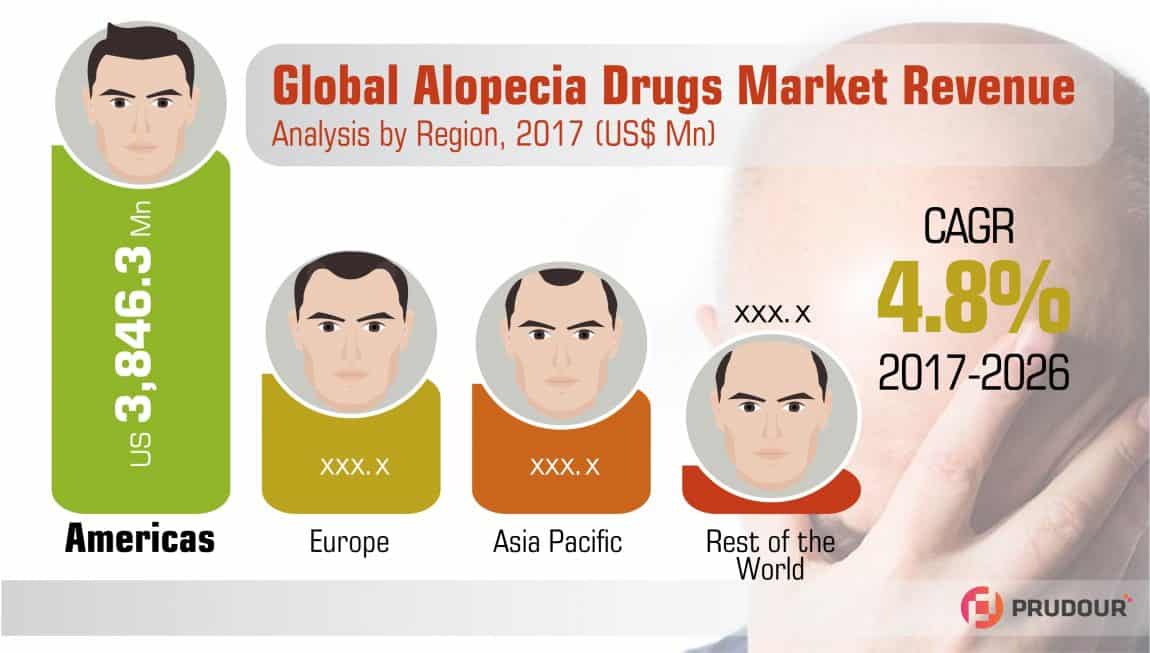 alopecia-market-infographics