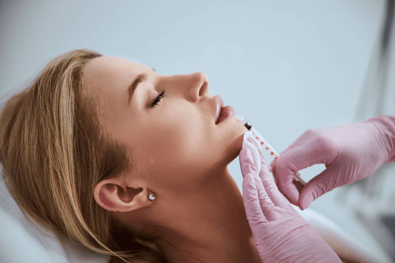 Lip Filler Swelling Stages