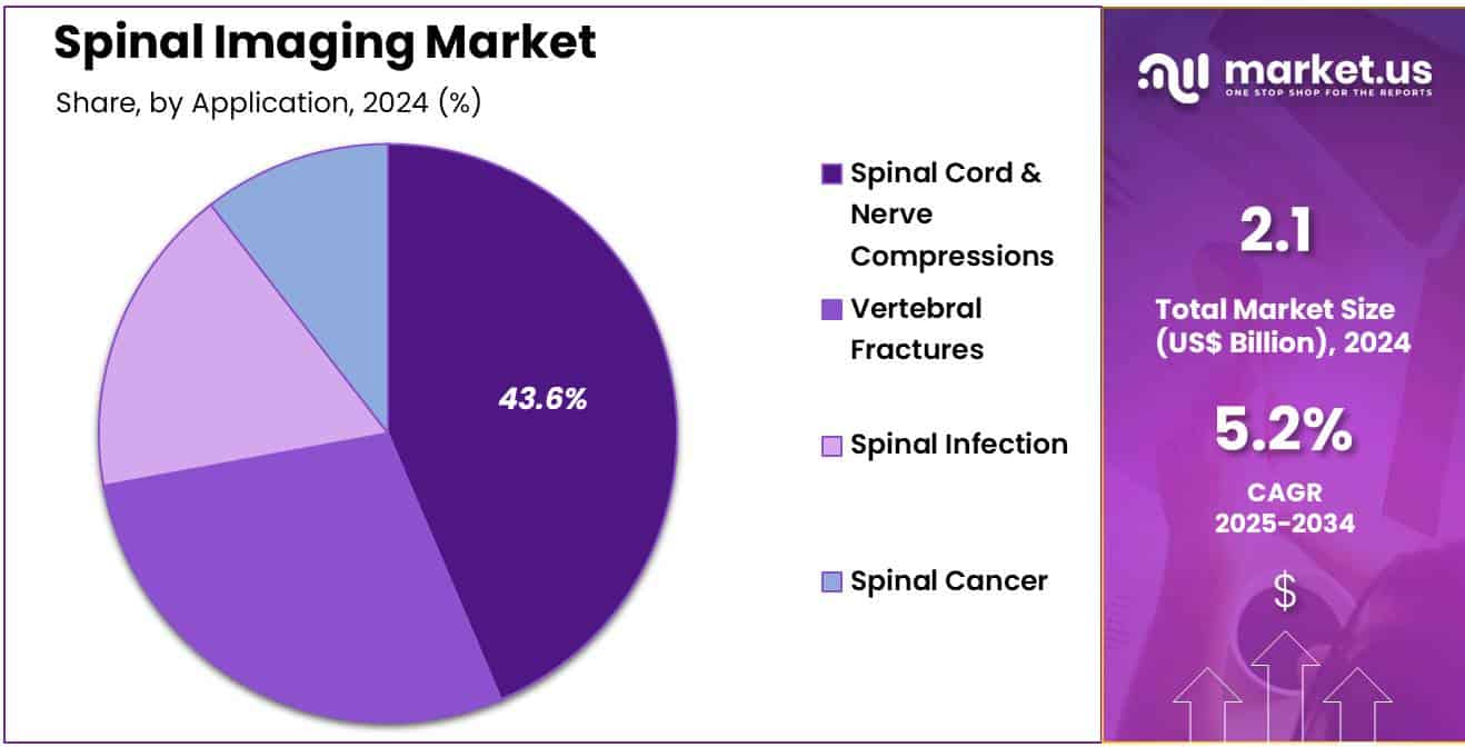 Spinal Imaging Market Share