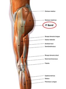 IT Band syndrome is an overuse injury that causes hip pain symptoms along the outer hip