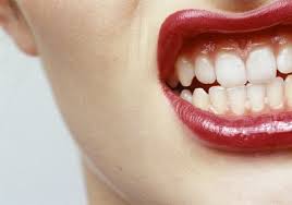 COMO A GENGIVITE COMPROMETE A SAÚDE BUCAL