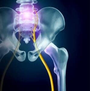 Sciatica Exercises can provide leg and hip pain relief