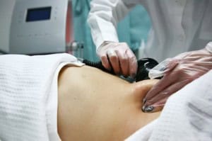 LIPOCAVITACAO O QUE E COMO FUNCIONA