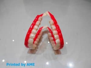 3d printing dental prosthesis