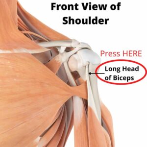Palpation of the long head tendon will recreate biceps tendinitis anterior shoulder pain