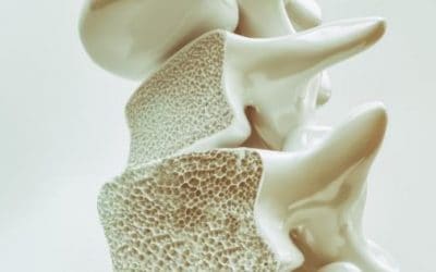 Can Osteoporosis Be Reversed?