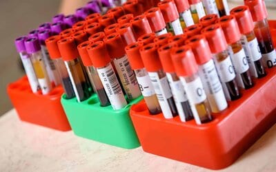 Houston, Can You Hear Us?