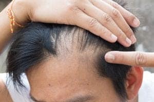 10 Powerful Tips To Regrow Your Hair & Restore Balance