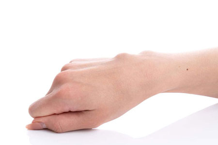 How is a Ganglion Cyst Diagnosed