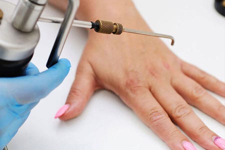Surgical-Excision