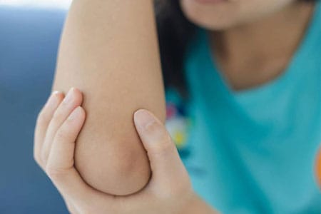 What-Are-the-Symptoms-of-a-Lipoma