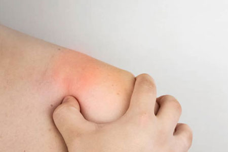 What-Causes-a-Lipoma-to-Grow
