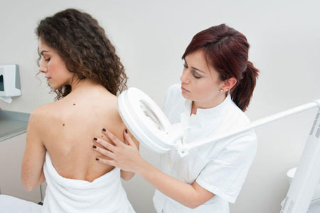 What-causes-moless