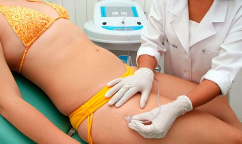 CARBOXITERAPIA - O QUE É, PREÇO, COMO FUNCIONA, EFEITOS COLATERAIS, ANTES E DEPOIS
