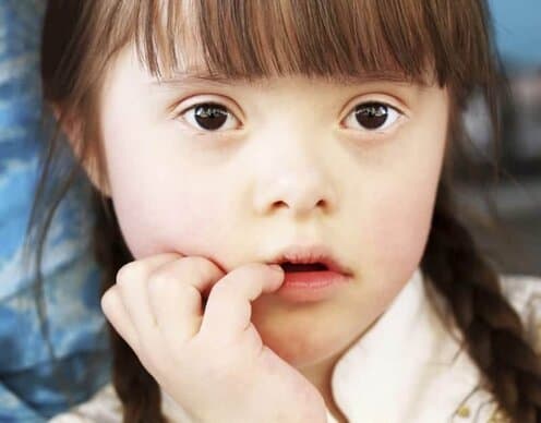 portrait of girl with down syndrome