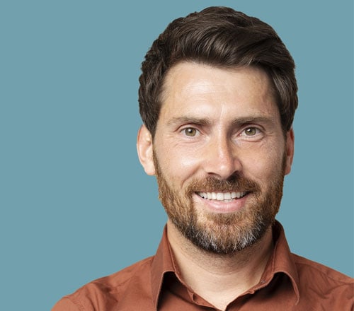 FUE-Hair-Transplant-Barnet