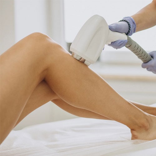 Laser-Hair-Removal