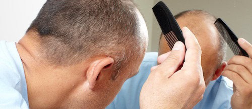 Hair Surgery Risk Factors