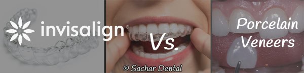 Invisalign vs porcelain veneers Picture of Invisalign trays and porcelain veneers in the background with text indicating Invisalign vs porcelain veneers