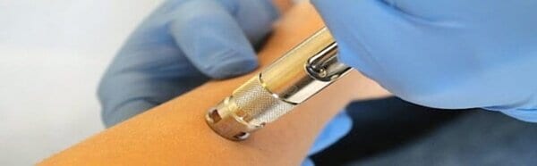 Needleless Anesthesia Device