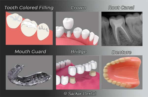 Sachar Dental NYC General dentistry Best Dentist NYC - General dentistry