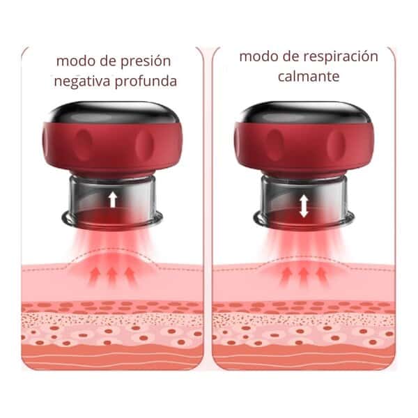 VENTOSA ELECTRICA - Imagen 3